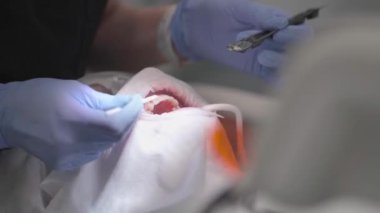 Diş hekimi, plaket ve tartardan dişlerini fırçaladıktan sonra hastanın dişlerine florür cila sürer. Diş minelerini güçlendirmek ve bakterileri önlemek için florür tedavisi.