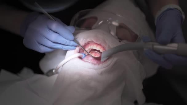 Dentista Examina Los Dientes Del Paciente Usando Espejo Dental Realiza — Vídeo de stock