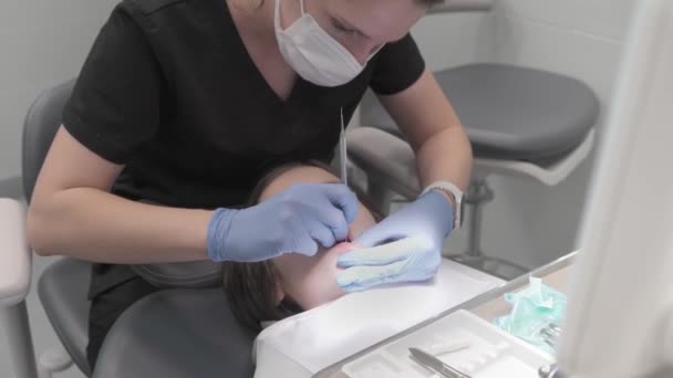 의사는 탐색기를 사용하여 어린이 환자의 치아를 검사합니다 치아와 잇몸의 검사를 — 비디오