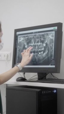 Bir ortodontist stajyer muayene eder ve röntgende dişlerin yapısını gösterir. Tıp eğitimi almak ve ileri düzey eğitim almak. Bir dişçi diş hastalığını teşhis eder..