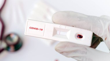 Doktor elinde viral hastalık için test kiti tutuyor. COVID-19.