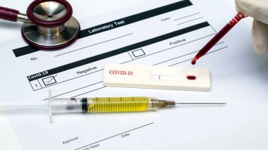 Doktor elinde viral hastalık için test kiti tutuyor. COVID-19.