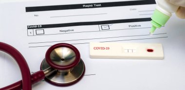 HIV için hızlı test kiti, beyaz arka plan, kan testi konsepti