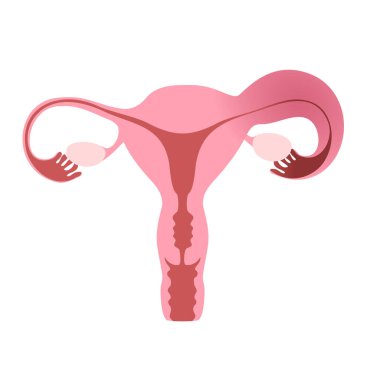 İnsan rahminin düz çizimi bir sağlıklı ve bir de iltihaplı dölyatağı tüpünü gösteriyor. Vektör illüstrasyonu