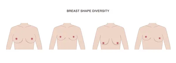 Düz gerçekçi tarzda farklı kadın göğüsleri. Çeşitli boyutlarda ve şekillerde çıplak kadın göğüsleri. Vektör illüstrasyonu
