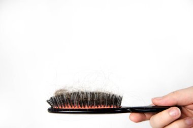 Saç dökülmesi sorunu, doğum sonrası dönemi, adet veya endokrin bozukluğu, hormonal disbalance, stres kavramı. Birçok saç düşmek içinde saç fırçası penye sonra. Kadın saçları tarak, kopya alanı ile untangles