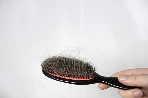 Hair loss problem, postpartum period, menstrual or endocrine disorder, hormonal disbalance, stress concept. Many hair fall after combing in hairbrush.Female untangles her hair with a comb, copy space