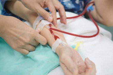 Tüplü hemodiyaliz makineleri, nakil, tıbbi ekipman konsepti.. 