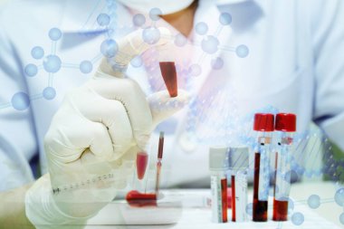 Double exposure of image of young female scientist holding tube with blood sample making and test or research glove with test tube. DNA research technology concept in clinical laboratory