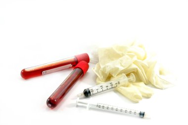 Empty vacuum blood collection tube Clotted blood tube for Medical laboratory