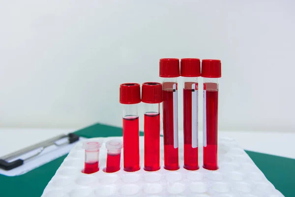 Tubes Blood Sample Rack — Stock Photo, Image