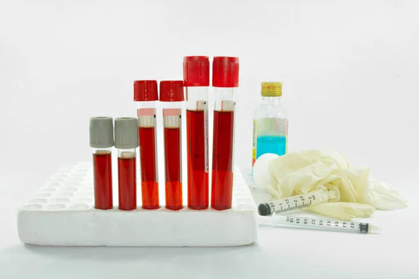 Blood sample in tube blood for screening test and syringe on white background.