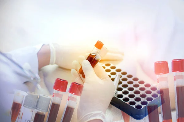2019 Ncov Analizi Için Çift Pozlama Çin Koronavirüsü Kan Testi — Stok fotoğraf