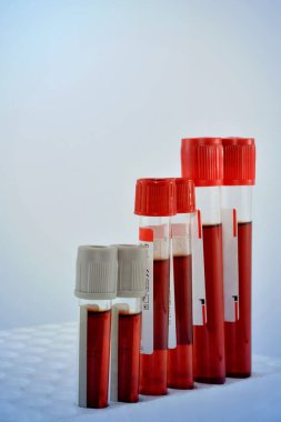 Tubes blood sample in rack.(blue tone)