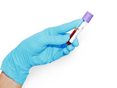science, chemistry, biology, medicine and people concept - close up of hand  holding test tube with blood sample making research in clinical laboratory isolate on white background
