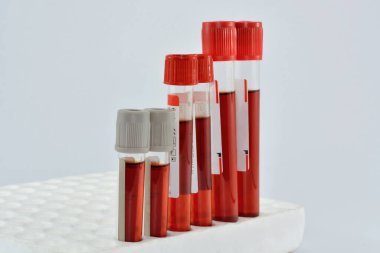 Tubes blood sample in rack