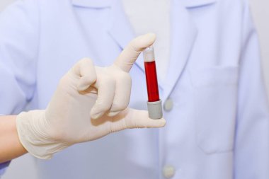 bilim, kimya, biyoloji, tıp ve insan kavramı - genç kadın bilim adamı kan örneği yapma ve test veya klinik laboratuvarda araştırma ile tüp tutan yakın