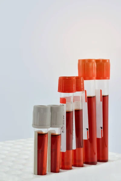 Tubes Blood Sample Rack — Stok fotoğraf