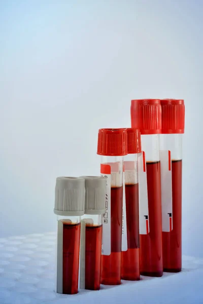Tubes Blood Sample Rack Blue Tone — Stok fotoğraf