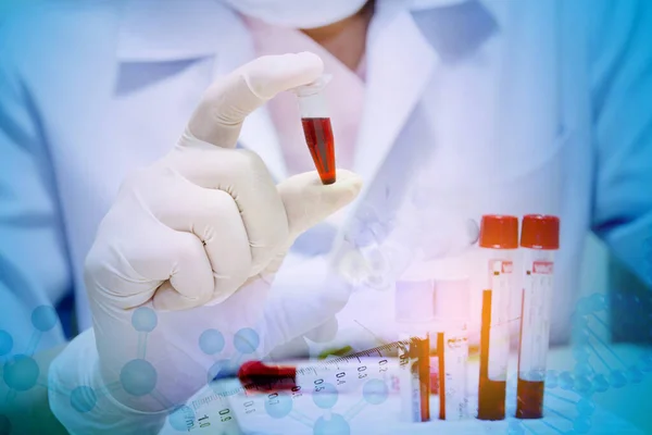 Bilim Kimya Biyoloji Tıp Insan Konsepti Laboratuvarda Kan Örneği Toplama — Stok fotoğraf