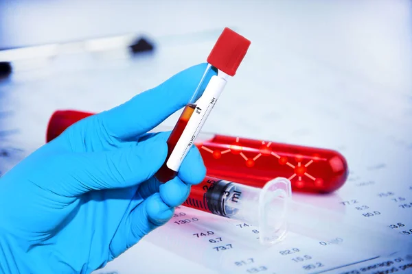 血液サンプル採取管と注射器を用いて 研究室内の血液のDna検査で血液サンプルを保持します ブルートーン — ストック写真