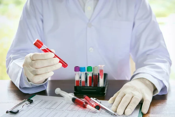 Klinik Laboratuarında Kan Örneği Oluşturan Test Eden Veya Araştırma Yapan — Stok fotoğraf