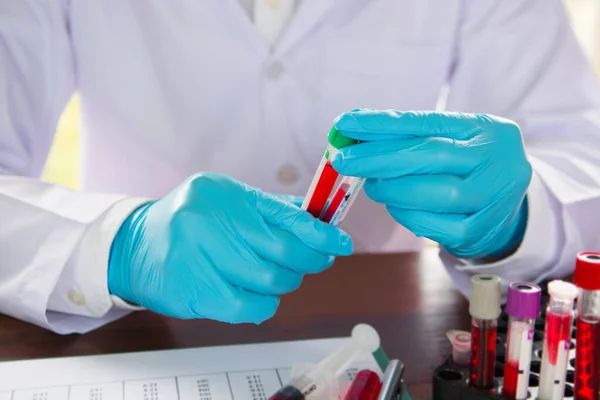 Klinik Laboratuarında Kan Örneği Oluşturan Test Eden Veya Araştırma Yapan — Stok fotoğraf