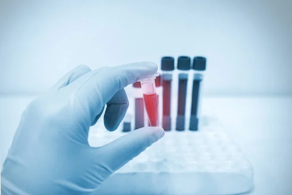 Klinik Laboratuarında Kan Örneği Oluşturan Test Eden Araştırma Yapan Bilim — Stok fotoğraf