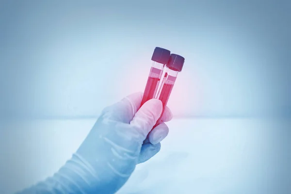 Klinik Laboratuarında Iki Tüp Tutan Bilim Adamına Yakın Çekim Mavi — Stok fotoğraf