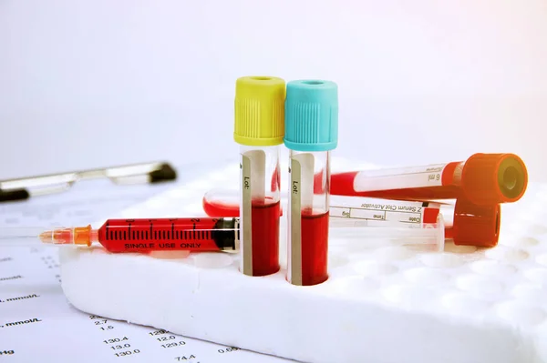 ラベンダーカラー血液サンプル採取管と注射器で血液分析レポート ブルートーン — ストック写真