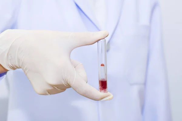 science, chemistry, biology, medicine and people concept - close up of young female scientist holding tube with blood sample making and test or research in clinical laboratory