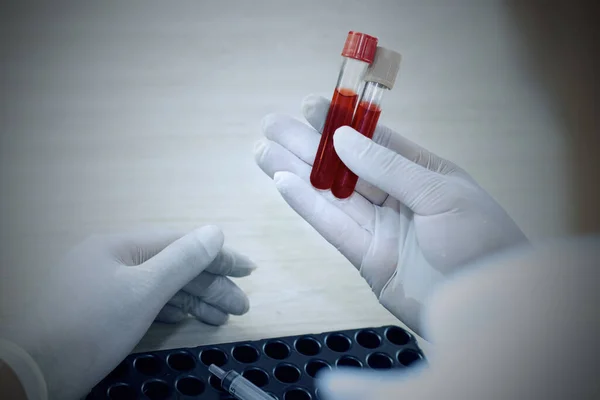 Elinde bir şişe kan tutan bir doktorun eli..