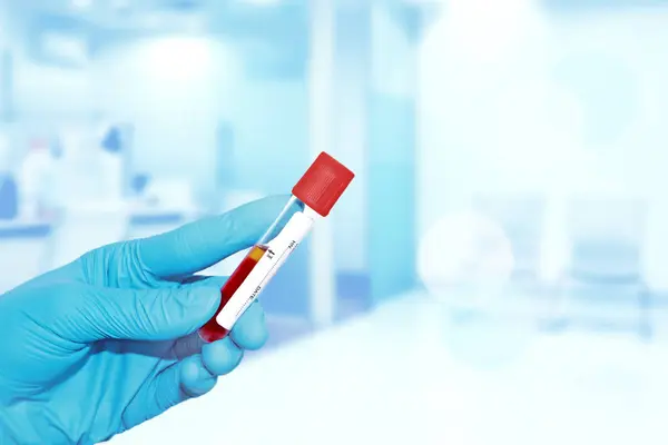 Doctor Hand Holding Test Tube Vacutainer Red Blood Testing Hematology Stok Resim