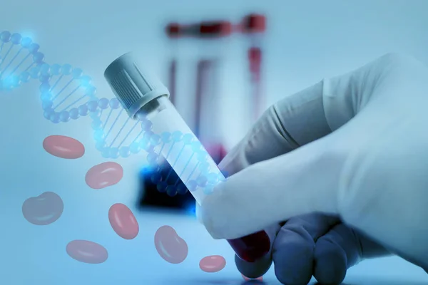 Doctor Hand Holding Test Tube Vacutainer Red Blood Testing Hematology - Stok İmaj