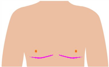 Beyaz arka planda trans kadın vücudunun ana hatlarının gösterimi, LGBT konsepti