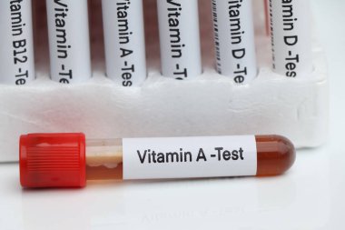 Laboratuvarda A vitamini için kan örnekleri, test tüpünde kan örnekleri.