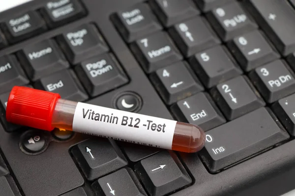 Vérminták B12 Vitamin Laboratóriumi Vizsgálatához Vérminta Kémcsőben — Stock Fotó