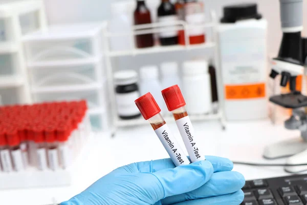 stock image Blood samples for testing vitamin A in the laboratory, blood sample in test tube