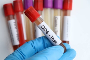 Kanda anormallik olup olmadığına bakmak için CD4 testi laboratuvarda analiz edilecek kan örneği, test tüpünde kan.