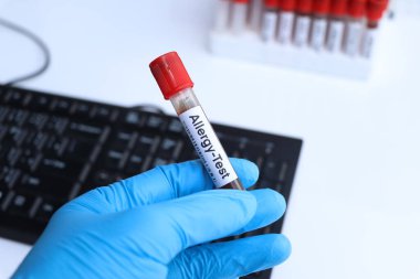 Kandaki anormallikleri araştırmak için alerji testi laboratuvarda analiz edilecek kan örneği, test tüpünde kan.
