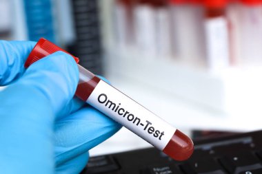 Kandaki anormallikleri araştırmak için Omicron testi laboratuvarda analiz edilecek kan örneği, test tüpünde kan.