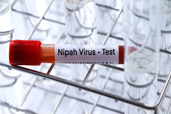 Stock image Nipah virus test to look for abnormalities from blood,  blood sample to analyze in the laboratory, blood in test