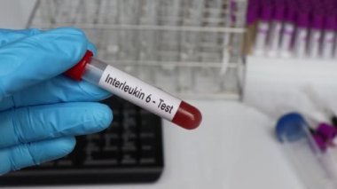 Kandaki anormallikleri araştırmak için Interlökin 6 testi laboratuvarda analiz etmek için kan örneği test tüpünde kan.