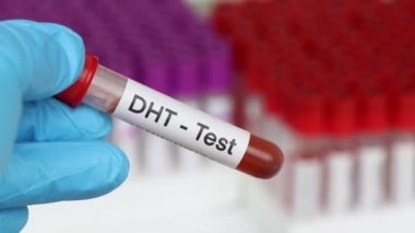 Kandaki anormallikleri bulmak için DHT testi laboratuvarda analiz edilecek kan örneği, test tüpündeki kan.