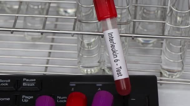 Interleucina Teste Para Procurar Anormalidades Sangue Amostra Sangue Para Analisar — Vídeo de Stock