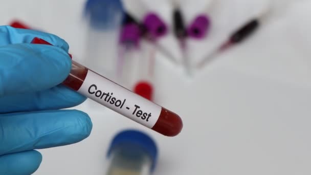 Pemeriksaan Kortisol Untuk Mencari Kelainan Dari Darah Sampel Darah Untuk — Stok Video