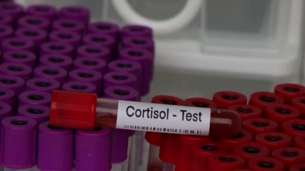 血液サンプルから研究室で分析する異常を探すためのコルチゾールテスト 試験管内の血液 — ストック動画