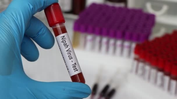 Prueba Del Virus Nipah Para Buscar Anormalidades Sangre Muestra Sangre — Vídeo de stock