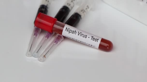 Prueba Del Virus Nipah Para Buscar Anormalidades Sangre Muestra Sangre — Vídeo de stock