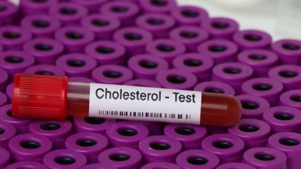 Cholesterol Test Zoeken Naar Afwijkingen Van Bloed Bloedmonster Analyseren Het — Stockvideo